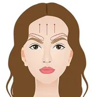 لیفت اندوسکوپیک ابرو و پیشانی