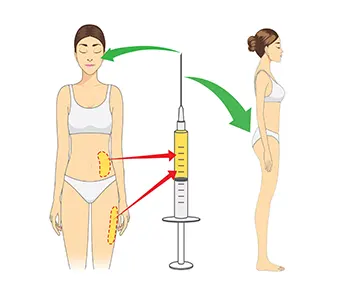 تزریق هیدروژل به باسن