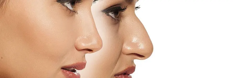 بهترین-روش-های-جراحی-زیبایی-بینی