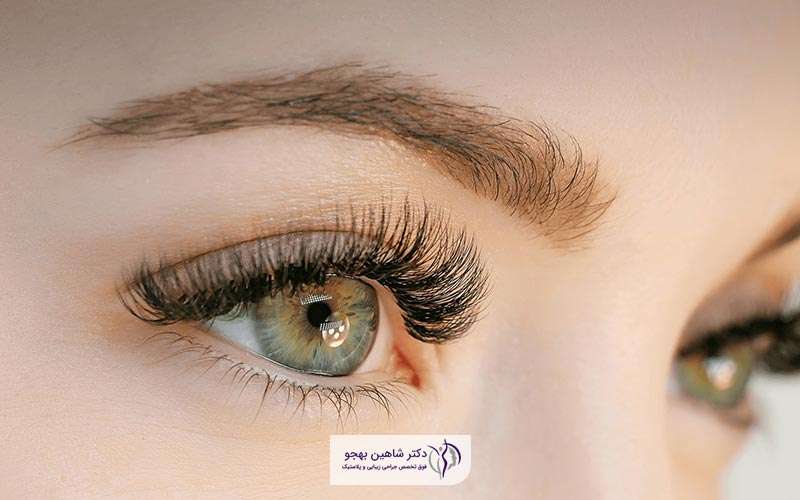 قیمت و هزینه جراحی لیفت ابرو در سال 1404 به چه عواملی بستگی دارد