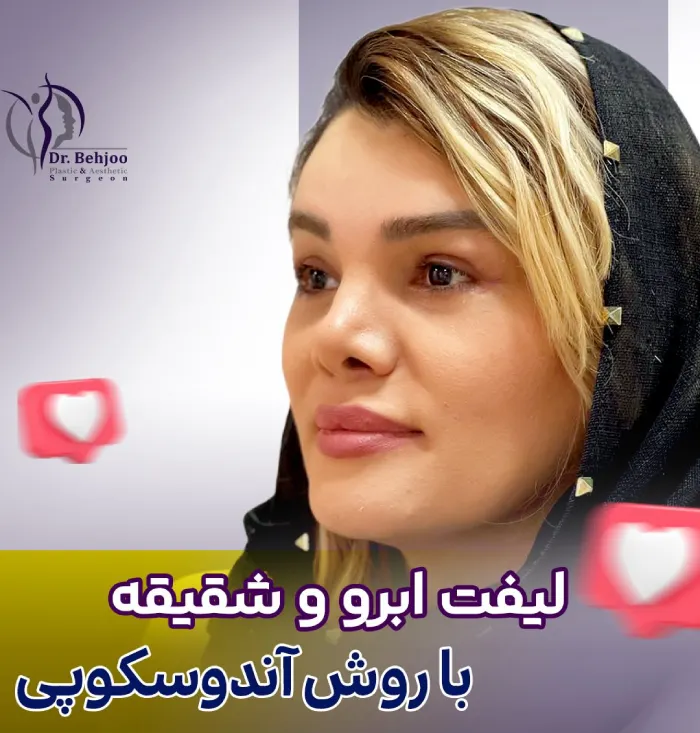 لیفت ابرو و شقیقه