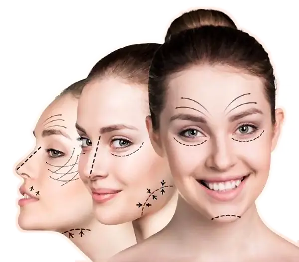 ماندگاری جراحی لیفت صورت