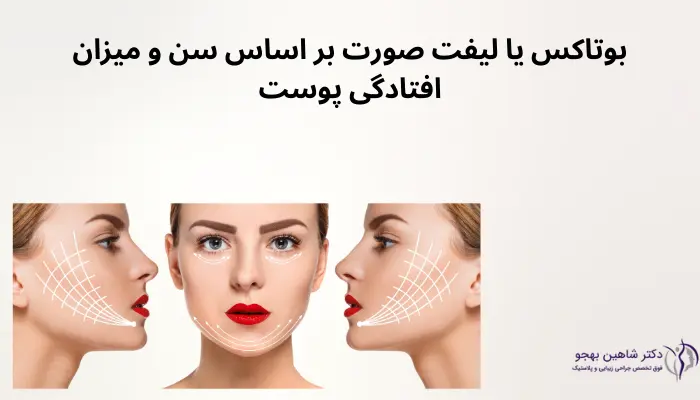 بوتاکس یا لیفت صورت بر اساس سن و میزان افتادگی پوست