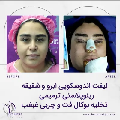 عکس بعد از جراحی