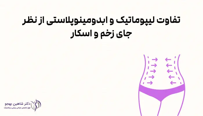 تفاوت لیپوماتیک و ابدومینوپلاستی از نظر جای زخم و اسکار