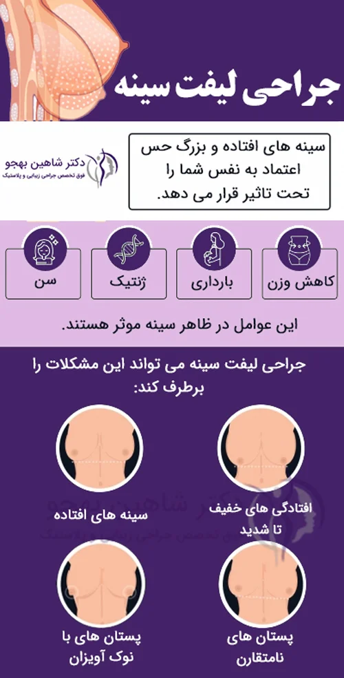 جراحی لیفت سینه