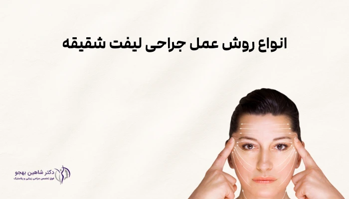انواع روش عمل جراحی لیفت شقیقه