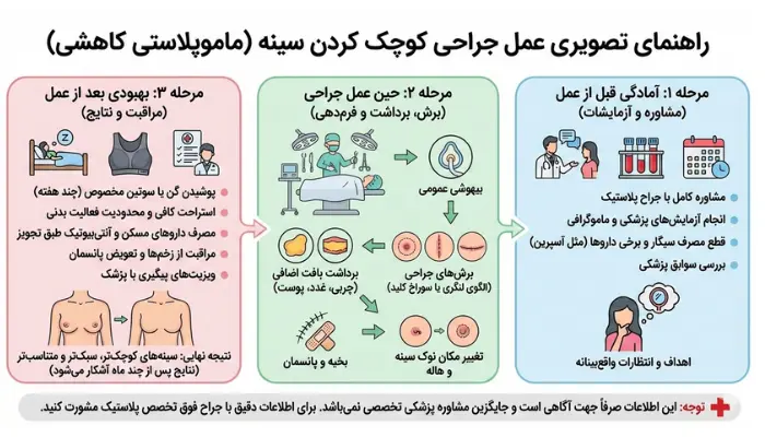 عمل جراحی کوچک کردن سینه چگونه انجام می شود؟