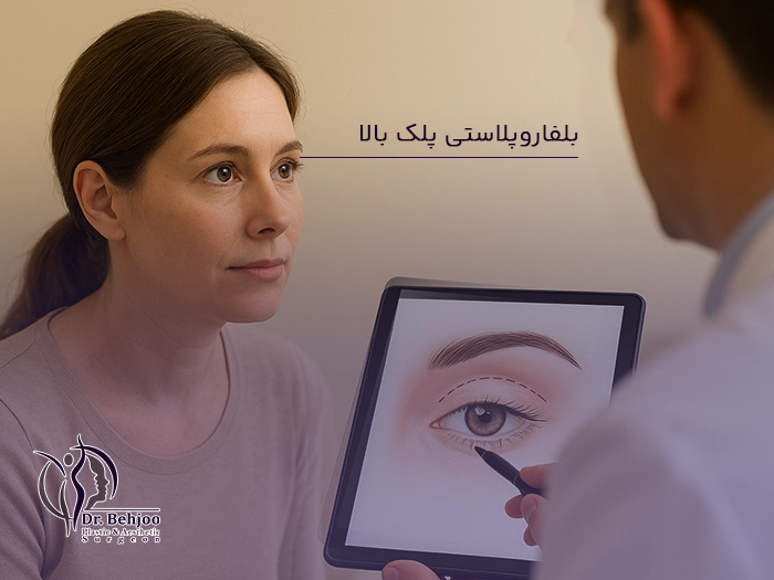 جراحی بلفاروپلاستی پلک بالا