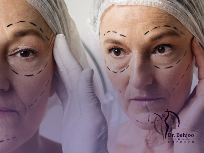 جای جراحی لیفت صورت