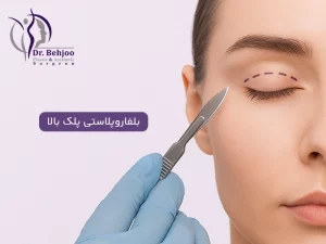 بلفاروپلاستی پلک بالا