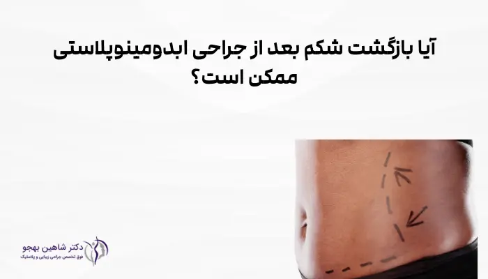 آیا بازگشت شکم بعد از جراحی ابدومینوپلاستی ممکن است؟