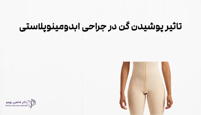 تاثیر پوشیدن گن در جراحی ابدومینوپلاستی