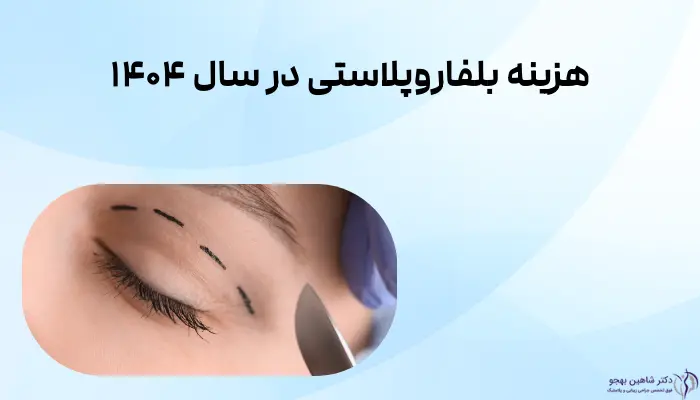 هزینه بلفاروپلاستی در سال ۱۴۰۴