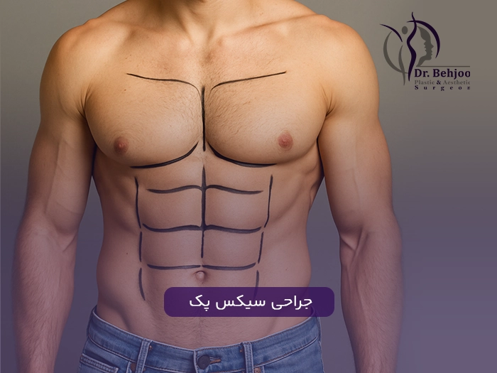 جراحی سیکس پک