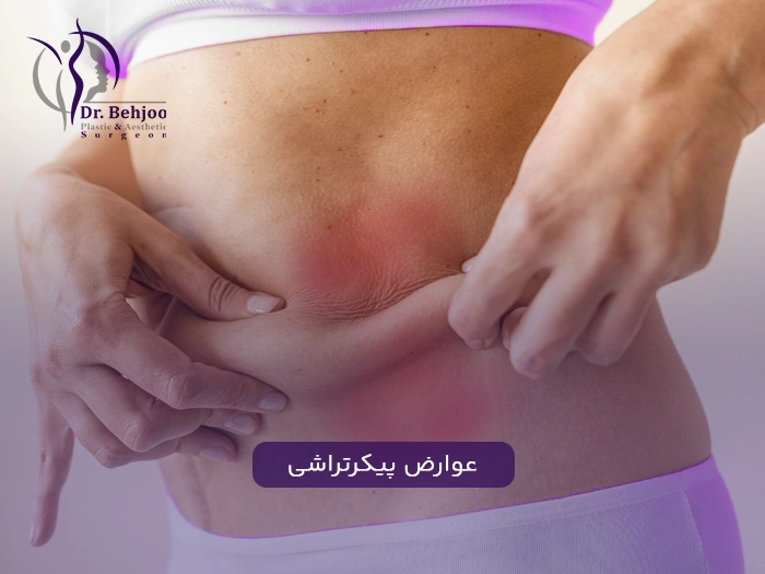 عوارض پیکرتراشی