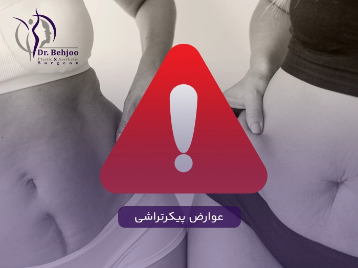خطرات پیکرتراشی