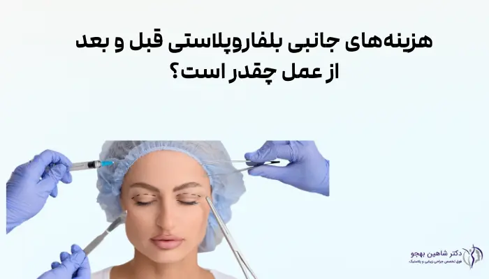 هزینههای جانبی بلفاروپلاستی قبل و بعد از عمل چقدر است؟