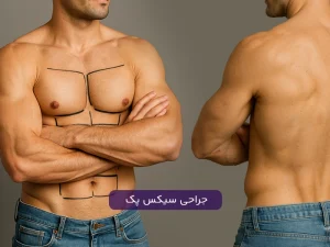 جراحی سیکس پک