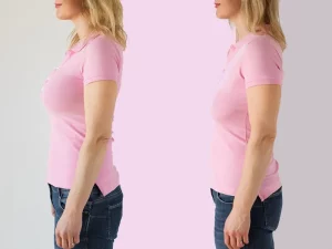 همه چیز در رابطه باجراحی لیفت سینه همزمان با پروتز سینه