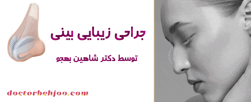 شستشوی بینی بعد عمل