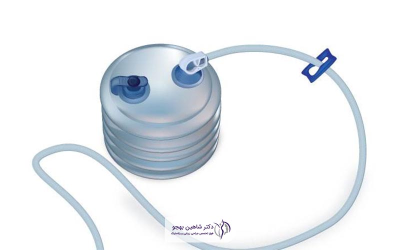 تصویر و عکس درن جراحی ابدومینوپلاستی شکم