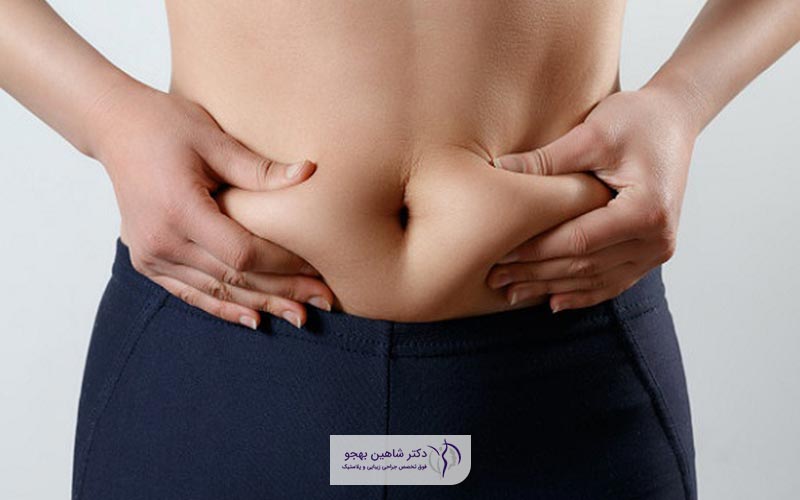 عمل لیپوماتیک شکم و پهلوها و تجهیزات مورد استفاده در آن