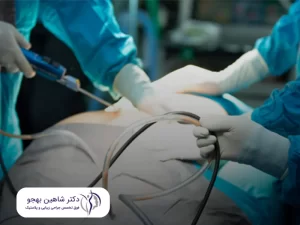 بهترین جراح لیپوماتیک در تهران دارای ویژگی‌های به خصوصی است.