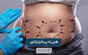 هزینه پیکرتراشی و قیمت کانتورینگ بدن در سال 1403