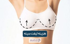 هزینه لیفت سینه در سال 1404 و عوامل موثر بر قیمت ماستوپکسی