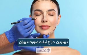 بهترین جراح لیفت صورت در تهران و معرفی ویژگی‌های آن و نحوه انتخاب آن