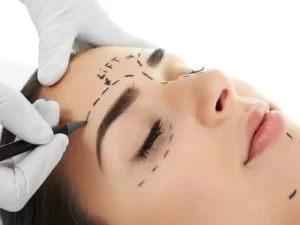 نتیجه جراحی لیفت ابرو
