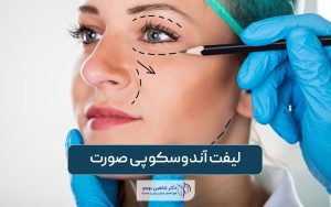 لیفت آندوسکوپی صورت و هزینه آن در سال 1403
