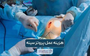 قیمت و هزینه عمل پروتز سینه در سال 1404 و عوامل موثر بر آن