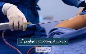 جراحی لیپوماتیک چیست؛ مزایا و عوارض عمل لیپو به همراه نحوه عمل آن