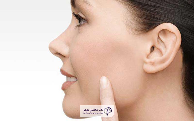 بهترین دکتر عمل تخلیه چربی دهان و گونه یا صورت در ایران و تهران کیست