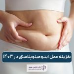 هزینه عمل ابدومینوپلاستی در سال 1403 و عوامل موثر بر قیمت عمل زیبایی شکم یا تامی تاک در ۱۴۰۳