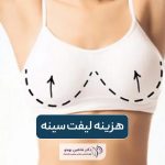 هزینه لیفت سینه در سال 1404 و عوامل موثر بر قیمت ماستوپکسی