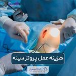 قیمت و هزینه عمل پروتز سینه در سال 1404 و عوامل موثر بر آن