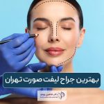 بهترین جراح لیفت صورت در تهران و معرفی ویژگی‌های آن و نحوه انتخاب آن