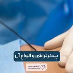 پیکرتراشی چیست و انواع پیکر تراشی به عنوان عمل جراحی زیبایی زنان و مردان